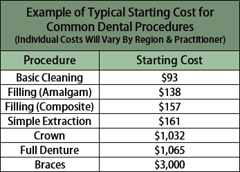 schema van typische startkosten voor gemeenschappelijke tandheelkundige ingrepen
