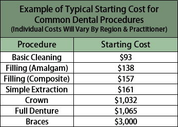 Chart of Typical Start Costs for Common Dental Procedures